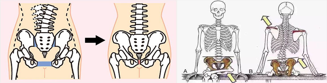 徒手整形_御唐整骨整形_御唐骨盆矯正術(shù)